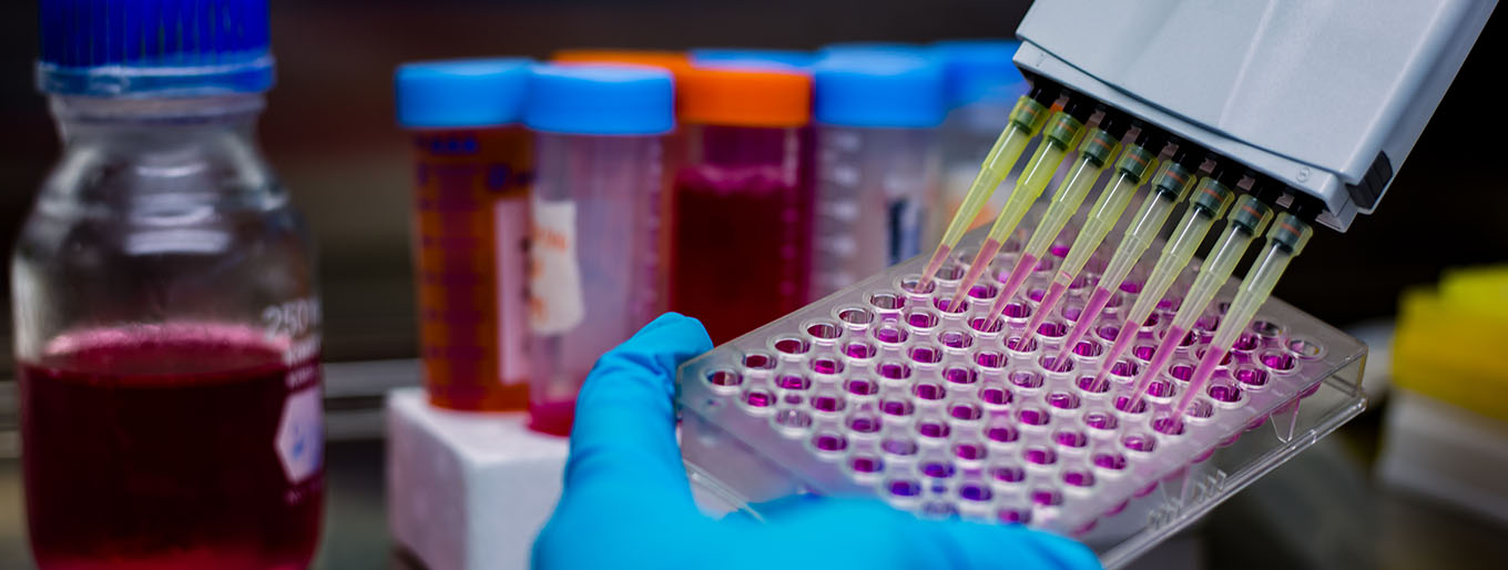 A Cytovance scientists using micropipette on 96 well microplate for cell line development services.
